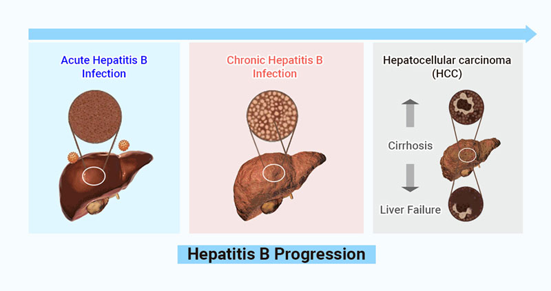 how-to-perform-hbv-dna-quantitative-test-by-real-time-pcr-daan-gene